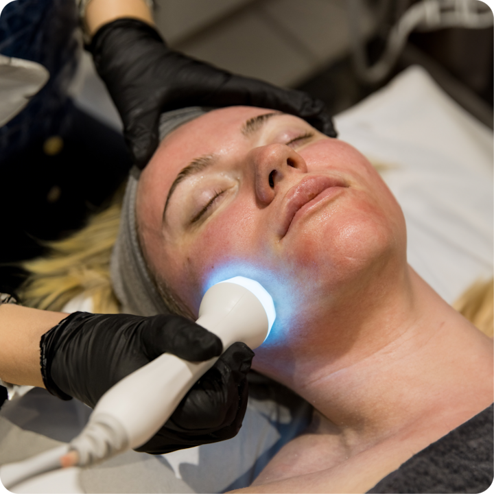 Une personne reçoit un soin du visage avec un appareil portatif émettant une lumière bleue, tenu par une personne portant des gants noirs.